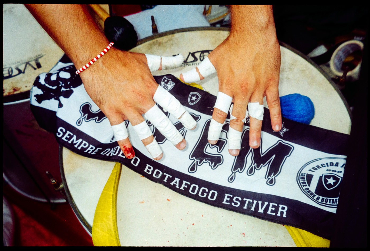 Duas mãos de dedos enfaixados apoiadas na pele de um surdo, sobre uma faixa de torcida