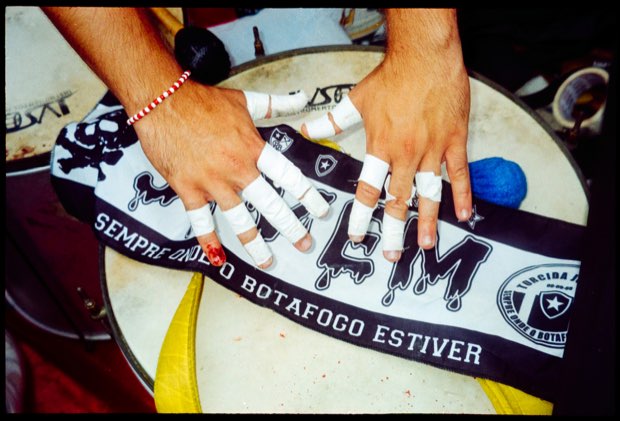 Duas mãos de dedos enfaixados apoiadas na pele de um surdo, sobre uma faixa de torcida